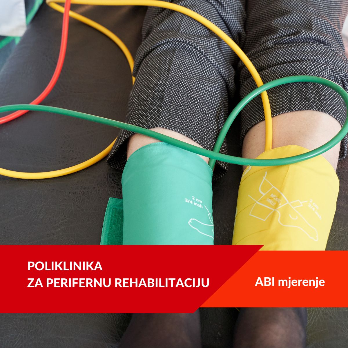 POLIKLINIKA ZA PERIFERNU REHABILITACIJU ABI mjerenje