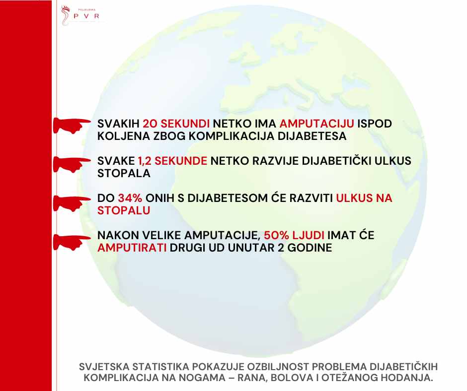 STATISTIKA dijabeticki ulkus
