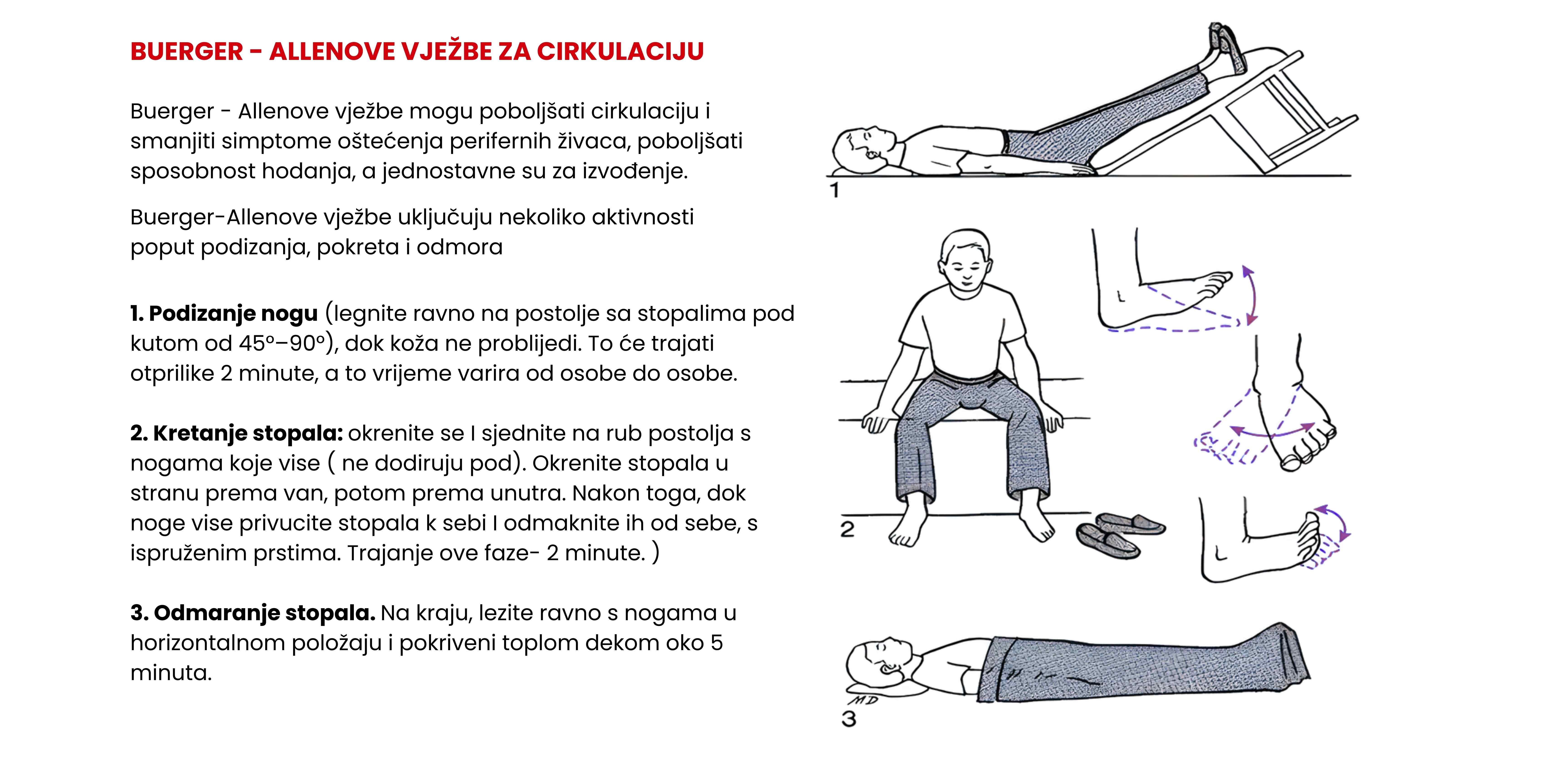 Buerger - Allenove vježbe